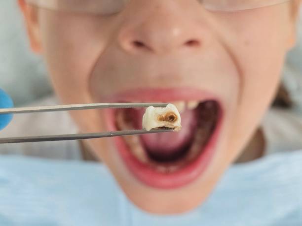 Best Emergency Dentist for Kids  in Mcchord Af, WA
